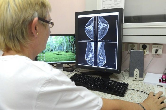 Ilustračný obrázok k článku V breznianskej nemocnici sa pokazil mamograf. Prístroj je neopraviteľný, vyšetrenia stopli